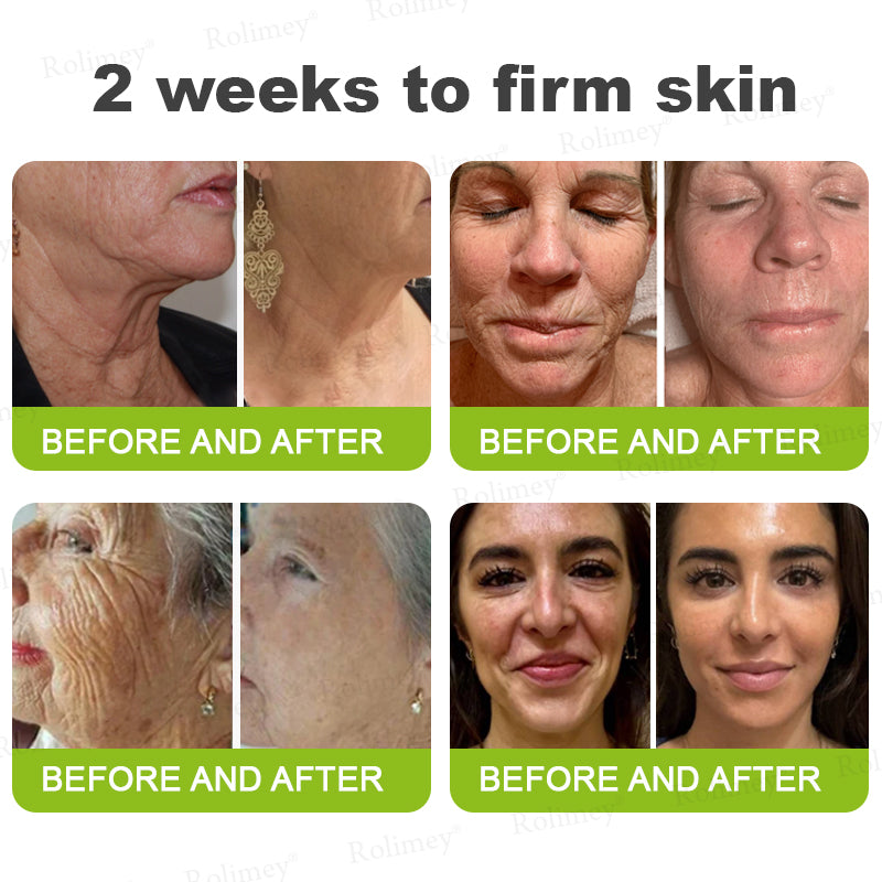 ☘️✨Made and shipped from Canada 💫Rolimey® Botox & Vita-A Retinol Shot Wrinkle-Lift Tightening cream - Last Day Promotion 70% OFF