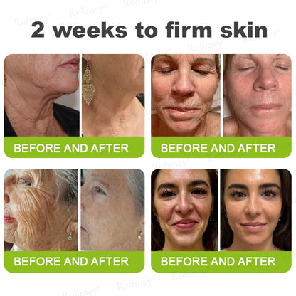 ☘️✨Made and shipped from Canada 💫Rolimey® Botox & Vita-A Retinol Shot Wrinkle-Lift Tightening cream - Last Day Promotion 70% OFF