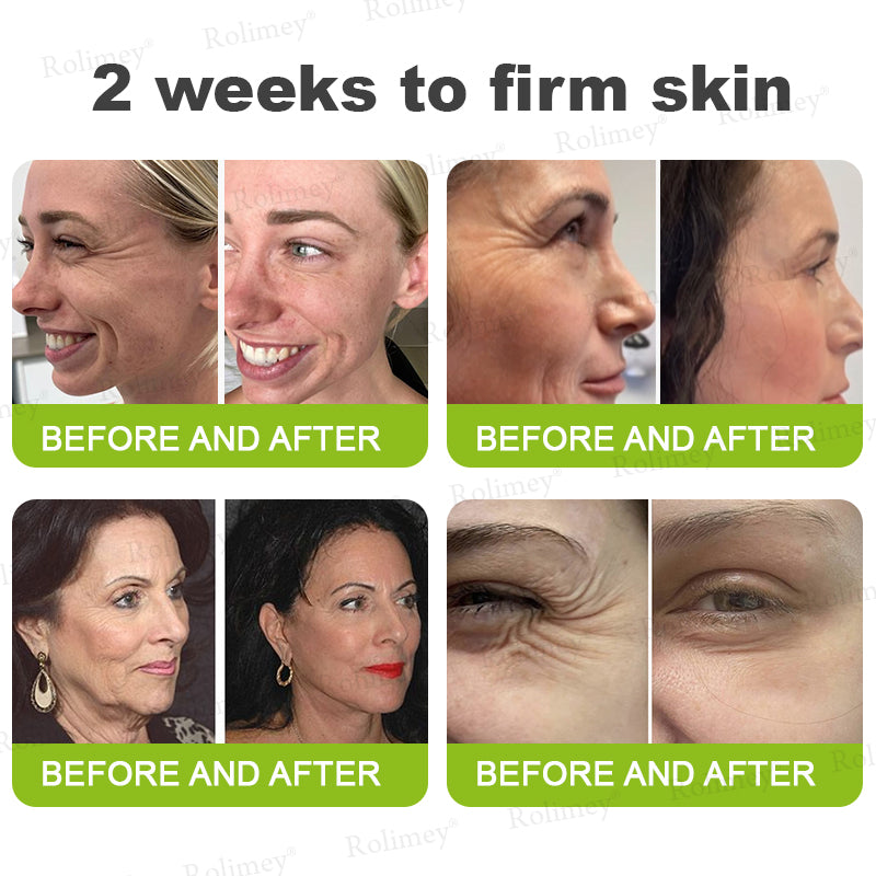 ☘️✨Made and shipped from Canada 💫Rolimey® Botox & Vita-A Retinol Shot Wrinkle-Lift Tightening cream - Last Day Promotion 70% OFF