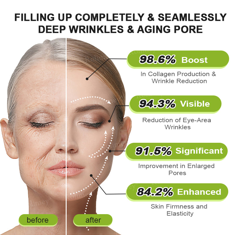 ☘️✨Made and shipped from Canada 💫Rolimey® Botox & Vita-A Retinol Shot Wrinkle-Lift Tightening cream - Last Day Promotion 70% OFF
