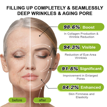 ☘️✨Made and shipped from Canada 💫Rolimey® Botox & Vita-A Retinol Shot Wrinkle-Lift Tightening cream - Last Day Promotion 70% OFF