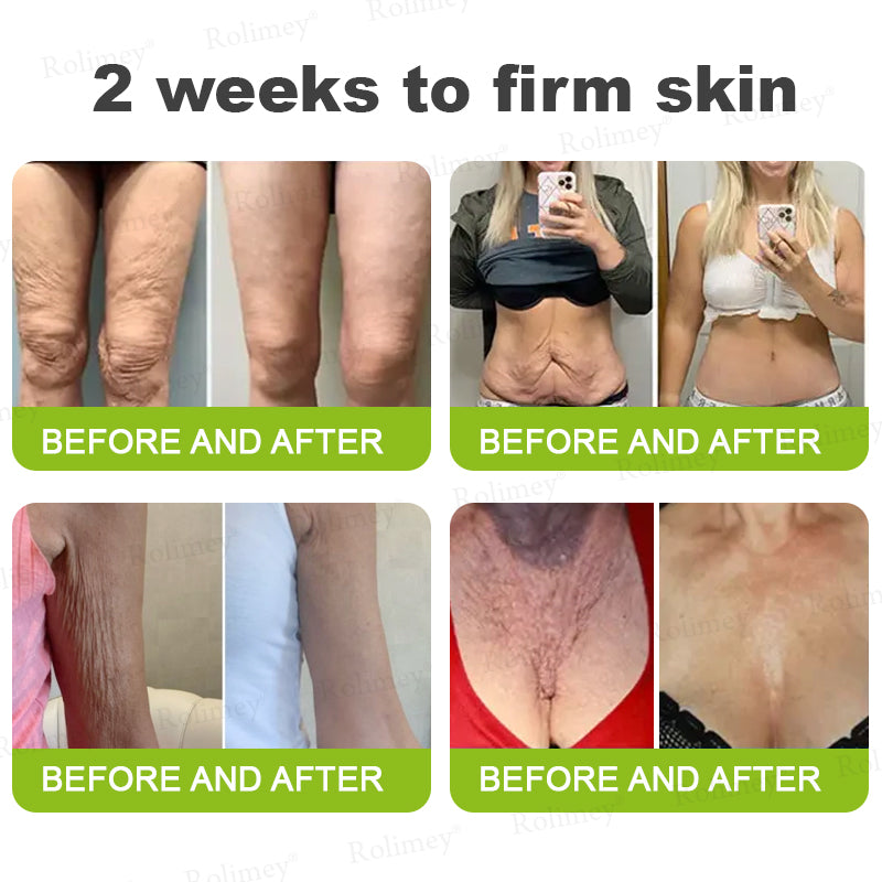 ☘️✨Made and shipped from Canada 💫Rolimey® Botox & Vita-A Retinol Shot Wrinkle-Lift Tightening cream - Last Day Promotion 70% OFF