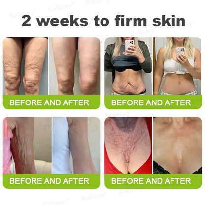 ☘️✨Made and shipped from Canada 💫Rolimey® Botox & Vita-A Retinol Shot Wrinkle-Lift Tightening cream - Last Day Promotion 70% OFF