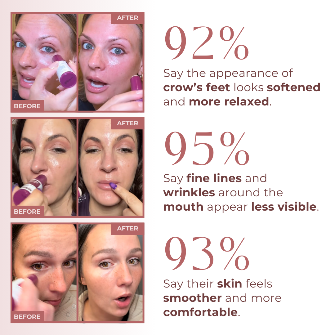 Soleilpeau Calcium Multi Balm – Firm, Plump & Brighten Aging Skin