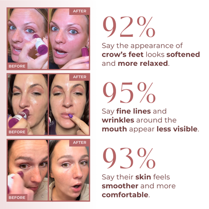 Soleilpeau Calcium Multi Balm – Firm, Plump & Brighten Aging Skin
