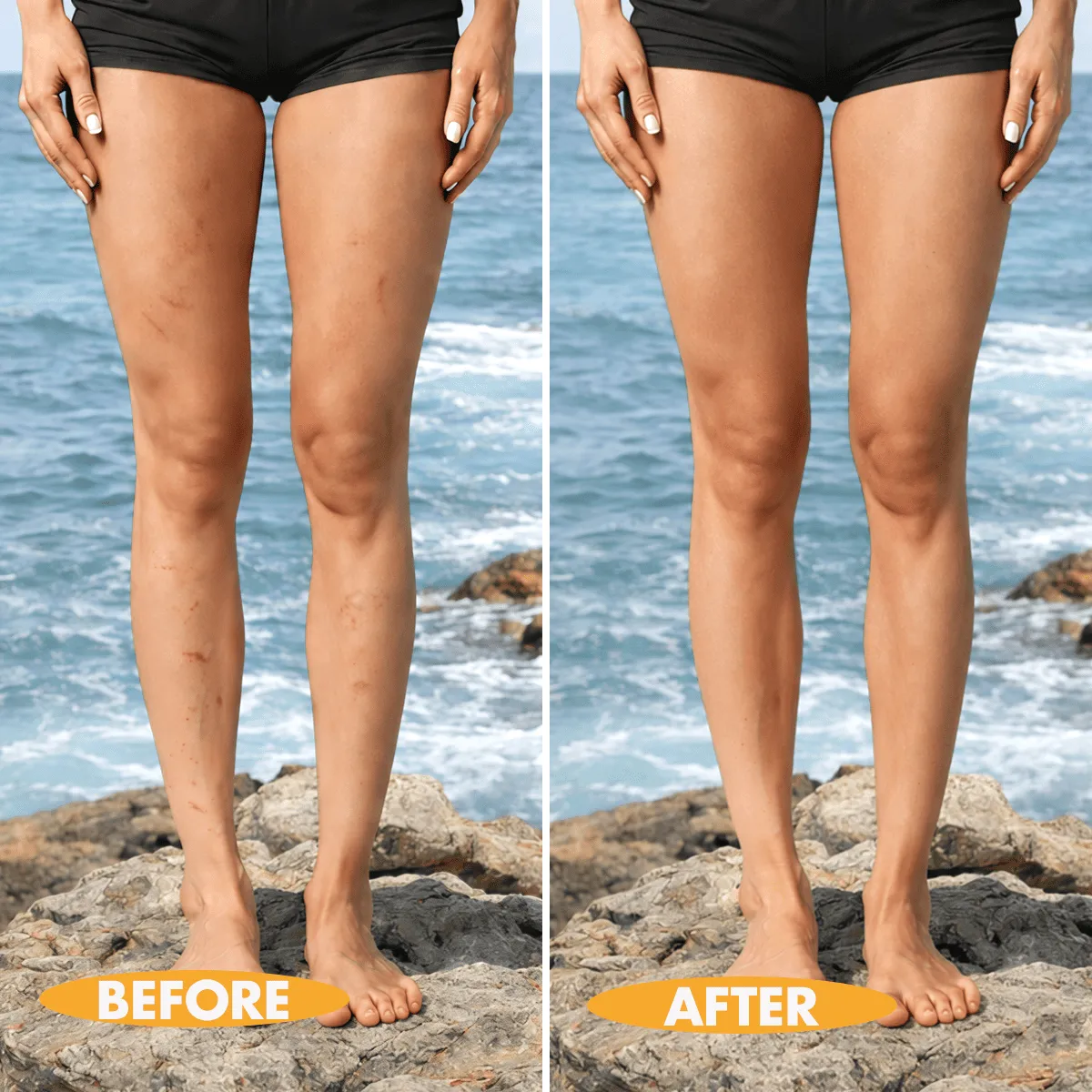 Before and after body concealer coverage on legs